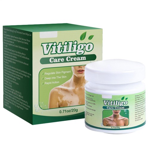 Vitiligo treatment white spot - vitiligo,